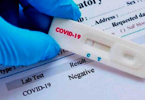 Test COVID-19: PCR, Antígeno, Inmunidad Celular.